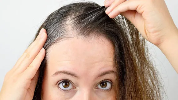 white hair