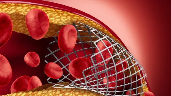 Good Cholesterol