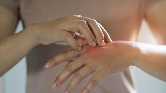 Skin itching home remedies