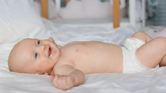 home remedies for diaper rash