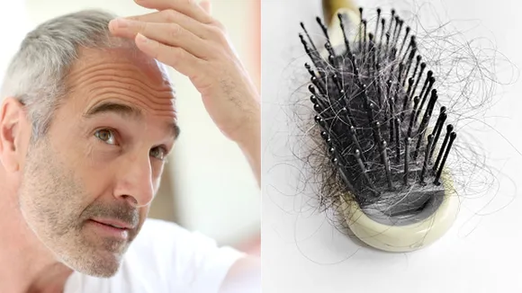 hair fall home remedies