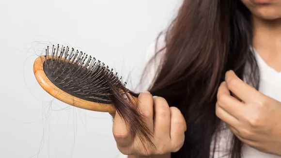 Hair Loss