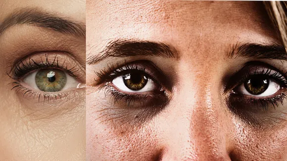 eyes