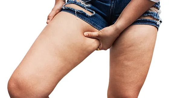 Reduce thigh fat exercise