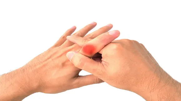 fingure