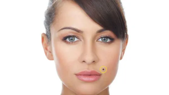 Moles on Female Body