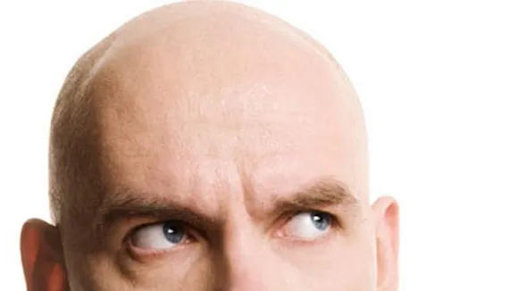 bald
