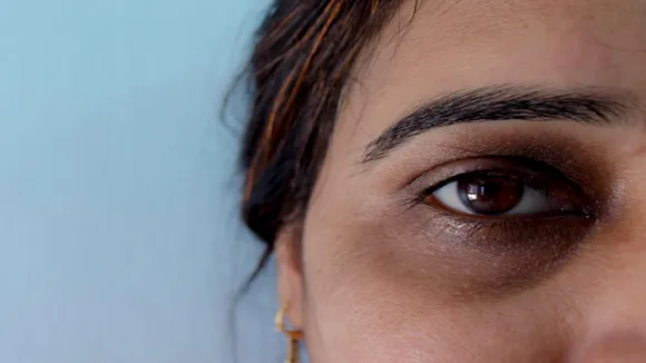 Grah Dasha Behind Dark Circles