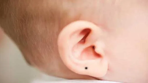 Ear Mole Meaning
