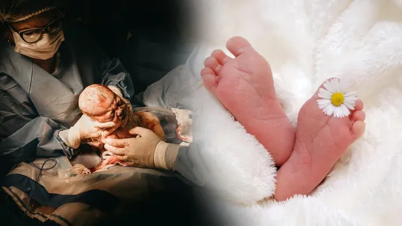 birthCollodion baby Ratlam MP सांकेतिक तस्वीर