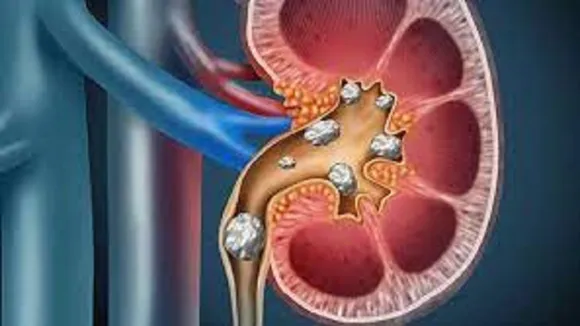 kidney