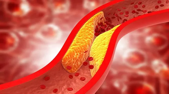 cholestrol