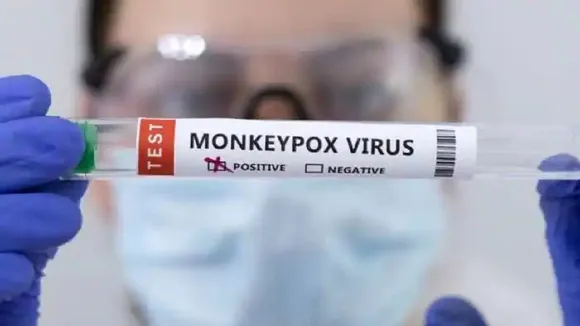 monkeypox
