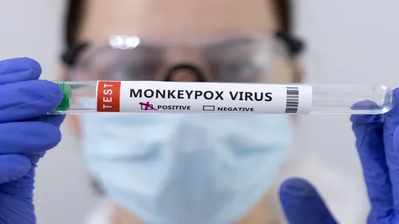 Monkeypox virus
