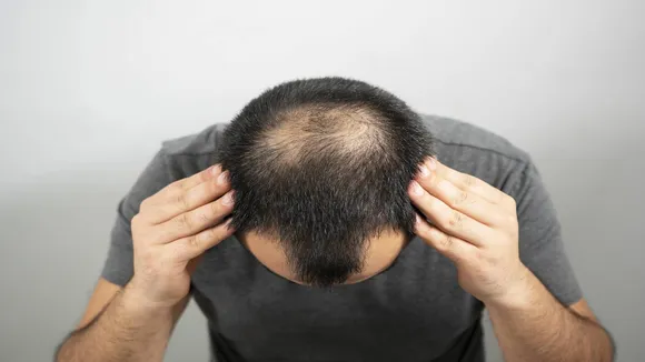 Hair fall