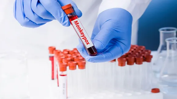monkeypox in kerala