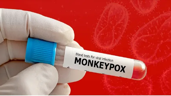 Monkeypox