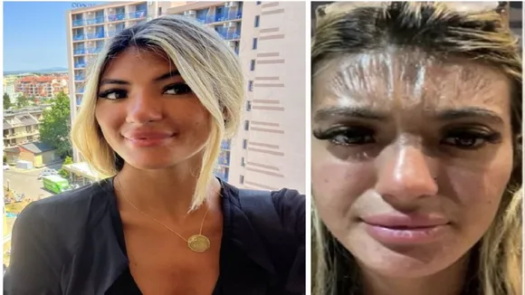 Woman Forehead Skin Looking Like Plastic