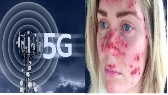 Effects of 5G technology1