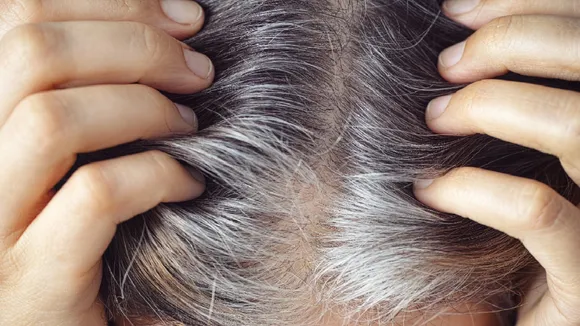 white hairs