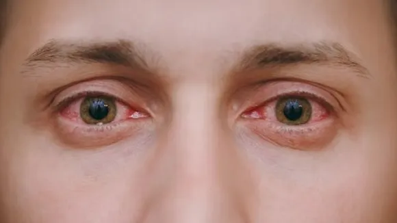Diabetic retinopathy