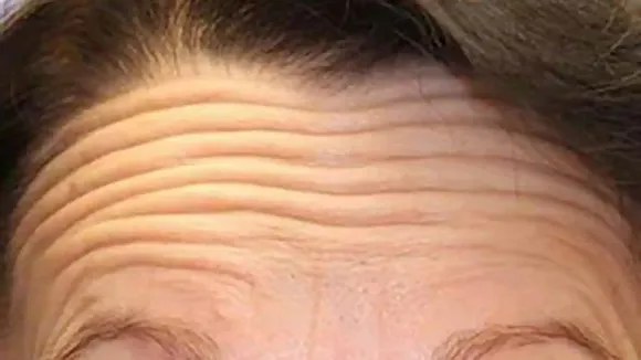Forehead Astrology 2023