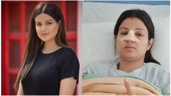 Sumati Singh Nose Surgery