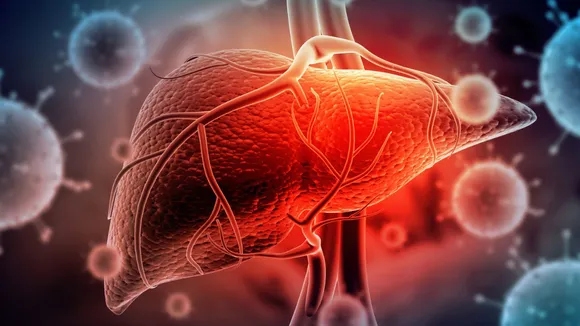 hepatitis