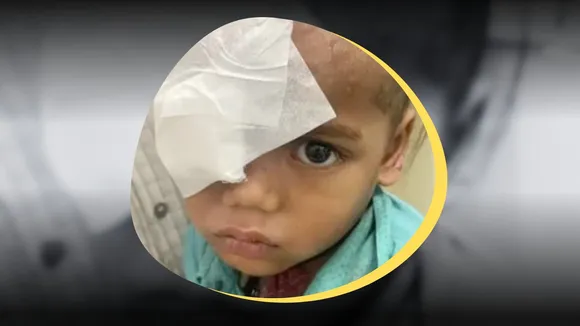 Eye operation