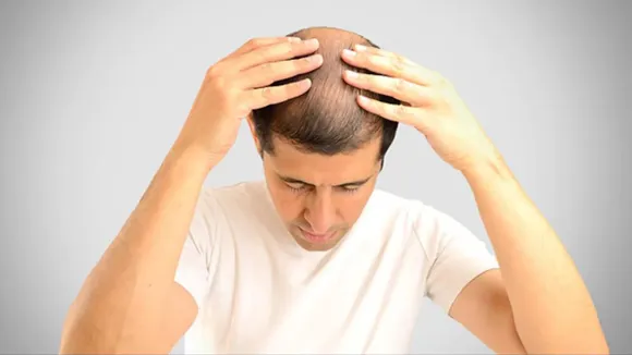hair-loss-cancer