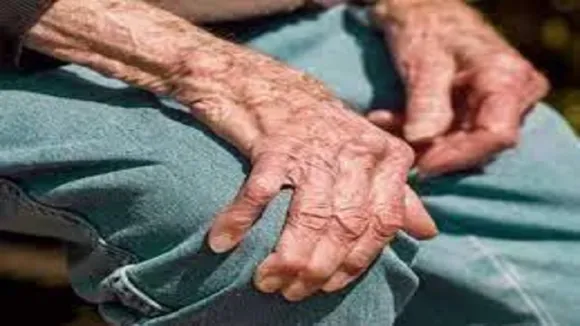 Arthritis Diseases