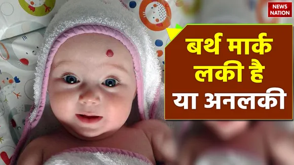 know whether your birthmark is lucky or unlucky