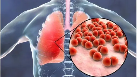mysterious -pneumonia