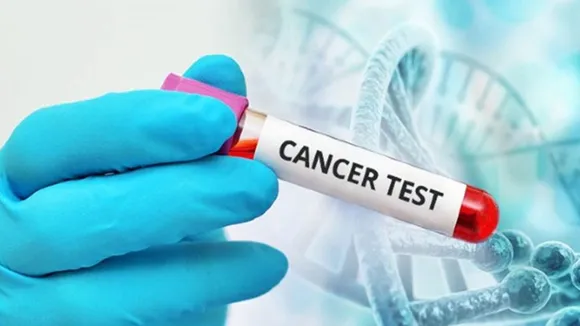 Cancer test Tips