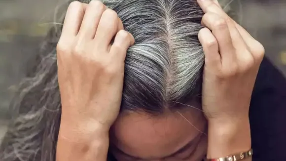 Why do hair turn white?
