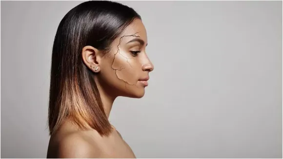How to keep skin in winter