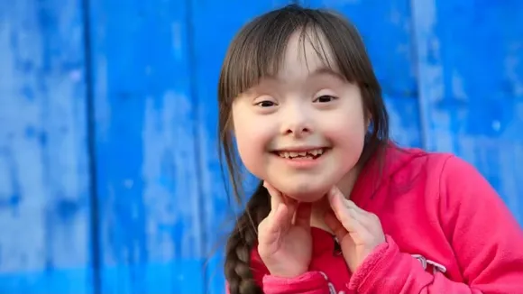 Down Syndrome