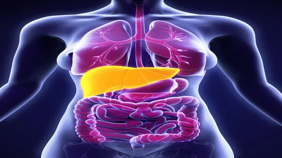 Fatty Liver