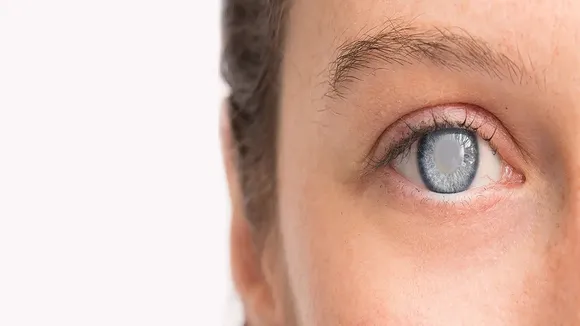 Symptoms of Cataract