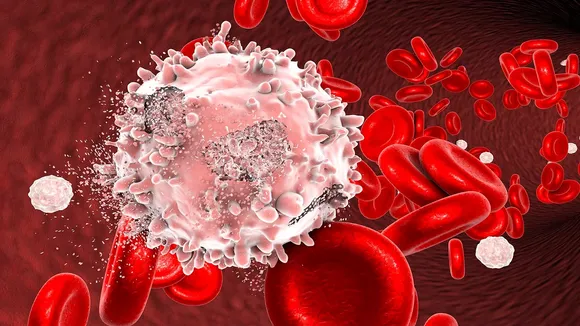 Leukemia Disease