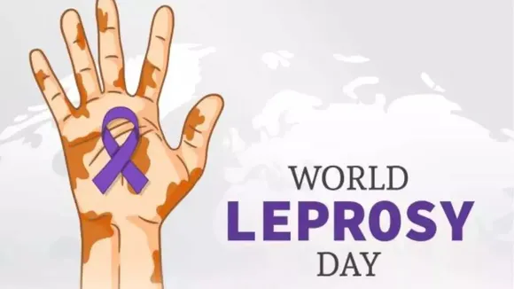 World Leprosy Day