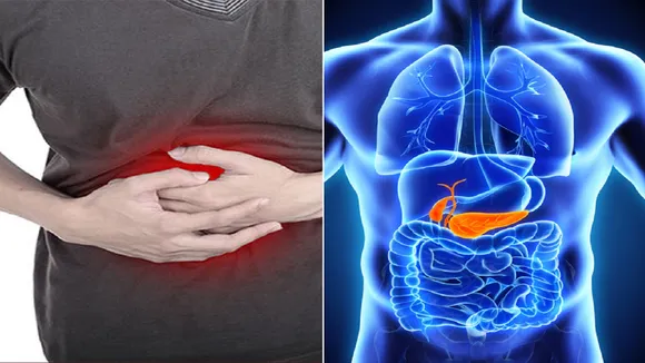 Pancreas Cancer