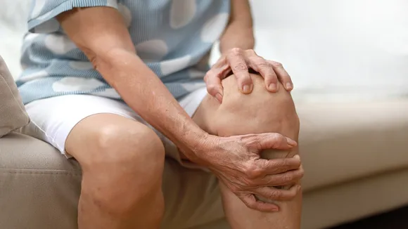 Arthritis Causes