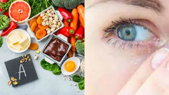 Vitamin A food