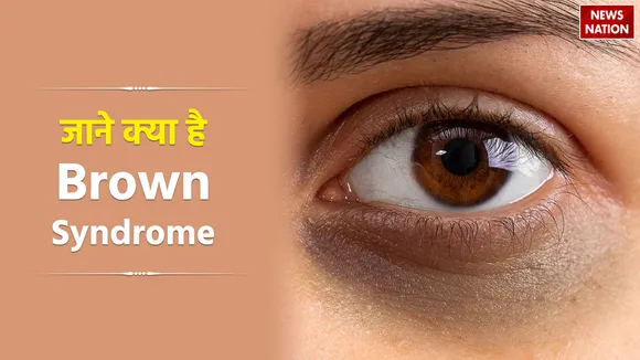 Brown Syndrome