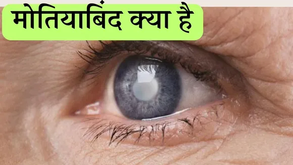 cataract disease