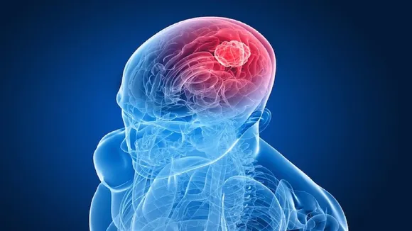 Brain tumours