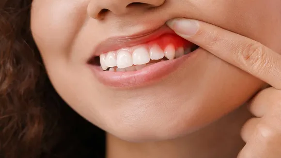 Tooth Care