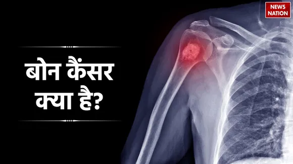 Bone Cancer