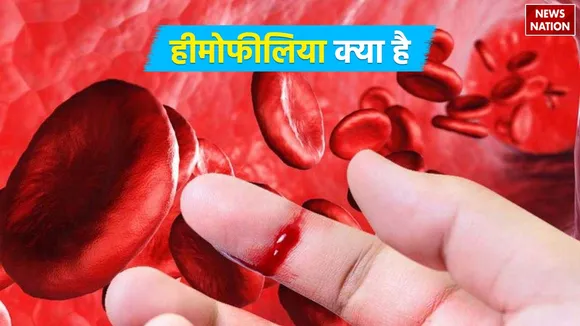 Hemophilia